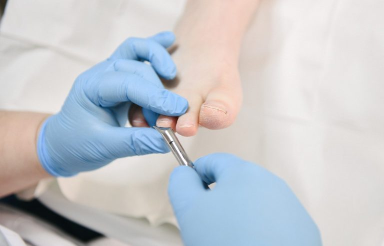 Nagels knippen Nagels knippen